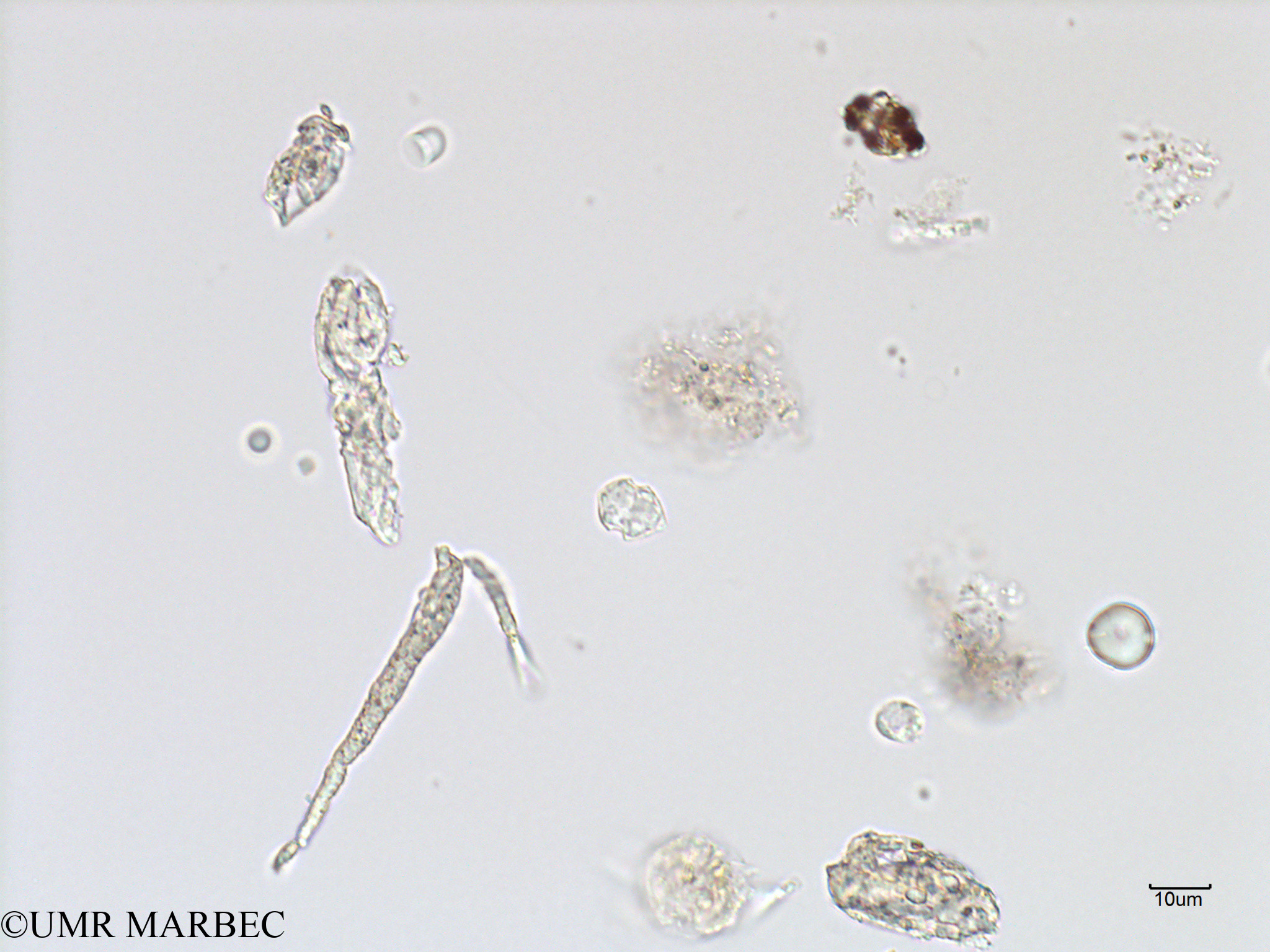 phyto/French_Polynesia/Arutua/ECOPE Janvier 2017/Scrippsiella spp (C1A_S2R2_050117_Scrippsiella-5).tif(copy).jpg